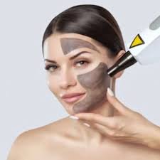 Carbon Facial Treatment