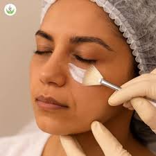 Dark Circle Treatment Before