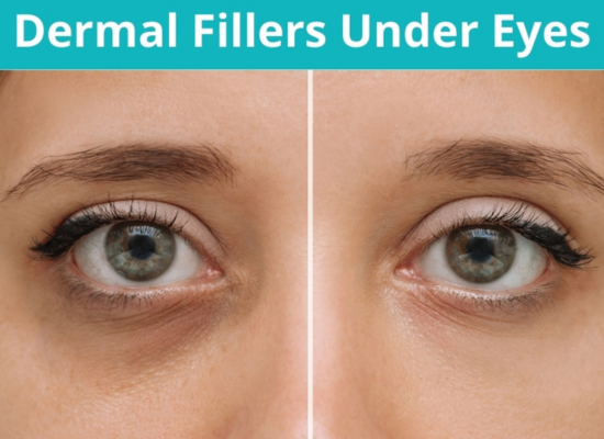 Dermal Filler Anti-Ageing