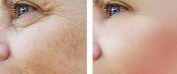 Skin Rejuvenation Glow
